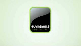 GlamSmile Porcelain Veneers [upl. by Jeremias]