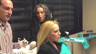 Juvederm Voluma Cheek Filler Demo  Dr Craig Jonov  Lynnwood WA [upl. by Ecirb890]