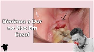 4 Dicas Para Diminuir a Dor no Dente do Siso em Casa  Pericoronarite Como Tratar [upl. by Einattirb]