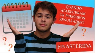 QUANTO TEMPO PARA OS PRIMEIROS RESULTADOS DA FINASTERIDA l MINHA EXPERIÃŠNCIA [upl. by Emirac]