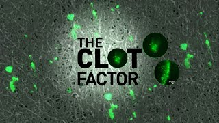 The Clot Factor  Full Measure [upl. by Nafri]