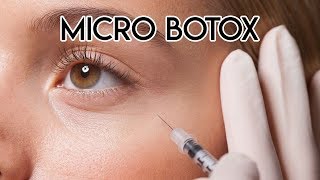 Micro Botox [upl. by Felise]