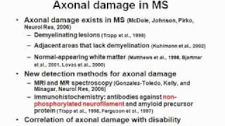 Multiple Sclerosis Inside Out model part 1wmv [upl. by Ellemac]