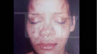 Chris Brown Assaults Rihanna For Giving Him Herpes [upl. by Nic]