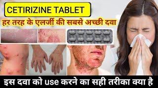 cetirizine hydrochloride tablets ip 10mg in hindi  Cetirizine tablets uses  Allergy Treatment [upl. by Dlareme160]