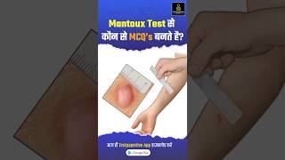 Mantoux Test क्या है और कैसे करते है  Tuberculin Skin Test Mantoux Test Results Reading shorts [upl. by Nowd]