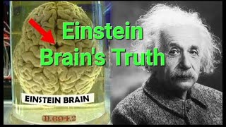 The Shocking Truth About Albert Einsteins Brain  alberteinstein informationstation18 genius [upl. by Athene]