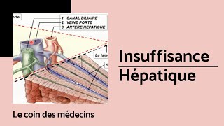 insuffisance hépatique [upl. by Aloap160]