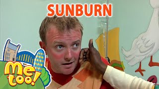 MeTooOfficialTVShow  ☀️🥵 Sunburn 🥵☀️  FullEpisode  SUMMER  TV Show For Kids [upl. by Frida100]