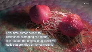 Osimertinib resistance in nonsmall cell lung cancer Pathways and potential solutions [upl. by Ellednahc]