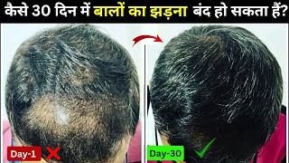 30 Days Thin To Thick Hair Challenge  Hair Regrowth Tips For Men  Hair Growth Tips  Dhru Rao [upl. by Lenneuq]