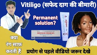 Vitiligo Parmanent treatment  Monobenzone cream for skin lightening [upl. by Methuselah]