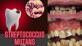 streptococcus microbiology lecture Streptococcus mutans S mutans Easy Microbiology [upl. by Bobbi353]