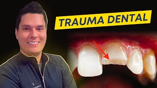 Traumatismo Dentários  Protocolos de Tratamento Guia Completo [upl. by Eillak]