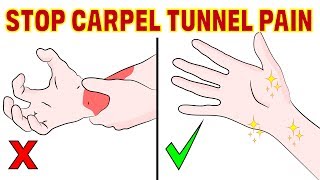 The 4 minute natural fix for carpal tunnel syndrome [upl. by Jadd]