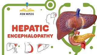 Hepatic Encephalopathy [upl. by Attener]