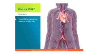 Central Lines Skills What is a CVAD [upl. by Chelsae173]