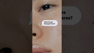 What causes enlarged pores How can I get rid of large pores Get all answers in our Pore Care Week [upl. by Netsew]