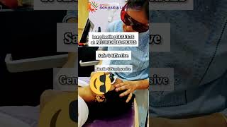 LASER HAIR REMOVAL for UNWANTED HAIR in Men amp Women drswethamadhaviyerroju vizag [upl. by Ayouqes193]