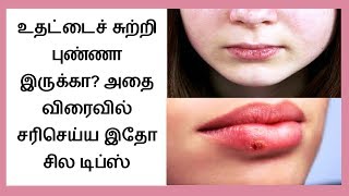 How to Get Rid of Dry Chapped Lips in tamil  Chapped Lips Remedy │Tamil Dear [upl. by Er]