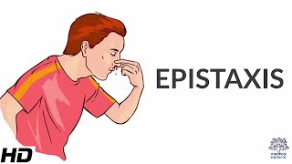 Epistaxis Causes SIgns and Symptoms Diagnosis and Treatment [upl. by Channing]