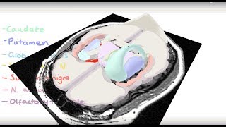 Basal Ganglia 3D Tour [upl. by Cline176]