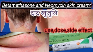 Betamethasone and Neomycin skin cream use in nepalibetnovate n cream useurticariapsoriasis treat [upl. by Fabrin]