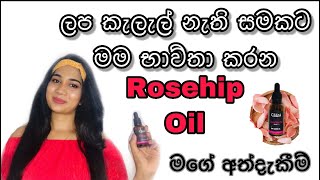 Benifits of Rosehip OilCliara Rosehip Oil reviewSinhala [upl. by Rauch]