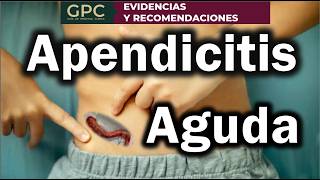 Apendicitis Diagnóstico y tratamiento ENARM 2024 [upl. by Lief304]