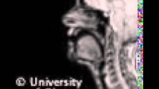 MRI voiced uvular implosive [upl. by Nochur990]