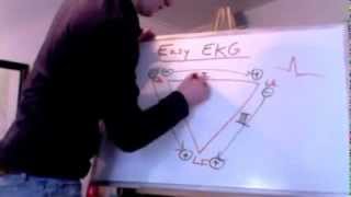 Easy EKG Einthovens Triangle [upl. by Avan]