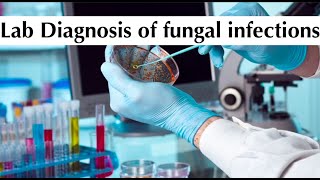 Microbiology 7th practical tuotorial quotLab Diagnosis of fungal infectionsquot by ASM Minds Team [upl. by Anomahs]