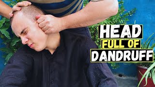 Dandruff Head Heavy Oily Head Massage ASMR To Relief Headache Neck amp Head Massage [upl. by Ameline]