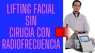 Rejuvenecimiento Facial sin Cirugía con Radiofrecuencia [upl. by Eizzil927]