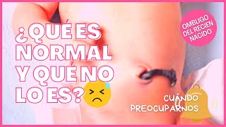 😵 Signos de ALARMA en el ombligo de un BEBÉ  ⚠️ ¿Cuándo consultar ¿Cómo cuidarlo 🔎 [upl. by Ijic]