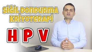 Siğil Dondurma Kriyoterapi  Doç Dr Erkan Erdem [upl. by Brantley962]