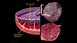 The Placenta and Umbilical Cord Ultrasound Video Lecture [upl. by Elleirol]