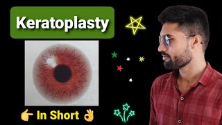 Keratoplasty lecture in opthalmology [upl. by Grider753]