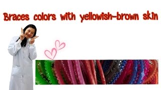 Braces colors with yellowish brown skin [upl. by Aitropal]