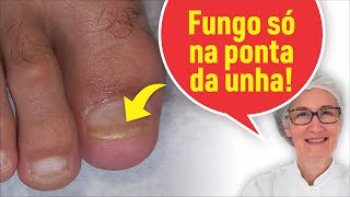 FUNGO SÓ NA PONTA DA UNHA [upl. by Awhsoj]