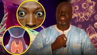 Goitre 2  Préventions et Solutions   Pr Ousmane Ndiaye  SAMA XALAAT TV [upl. by Zweig50]