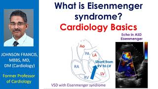 What is Eisenmenger syndrome Cardiology Basics [upl. by Fania305]