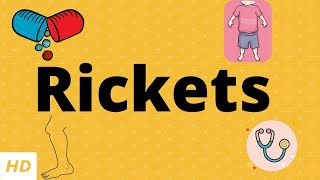 Rickets Causes Signs and Symptoms Diagnosis and Treatment [upl. by Card]