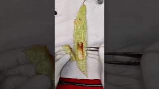 fish in bitter gourd need to surgery 🤯shorts fruitsurgery youtubeshorts [upl. by Sumedocin411]