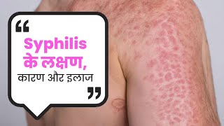 Syphilis Causes Symptoms And Treatment  यौन संबंध बनाने से हो सकती है गंभीर बीमारी SyphilisCauses [upl. by Aderb212]