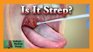 Is it Strep Throat  Auburn Medical Group [upl. by Nahtnhoj124]