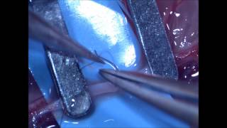 Microsurgical arterial endtoend anastomosis basic technique [upl. by Yellat142]