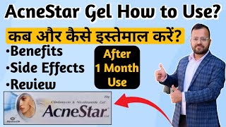 Acne Star Gel  Acne Star Gel Price  Acne Star Gel Review  Acne Star Gel Uses  Review king [upl. by Terrye]