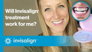 Will Invisalign® treatment work for me  Invisalign [upl. by Squires28]