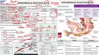 Hemorragia Digestiva [upl. by Calder]